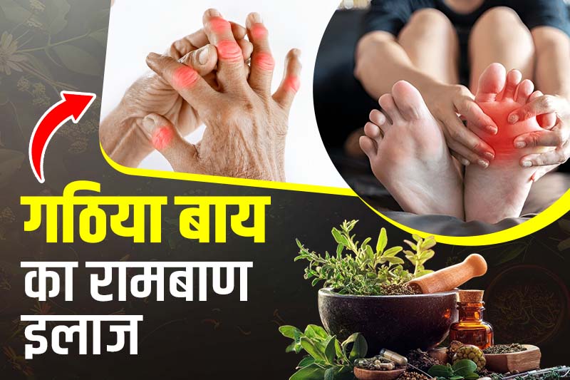 सन्निपातिक आर्थराइटिस एवं स्पॉन्डिलाइटिस
