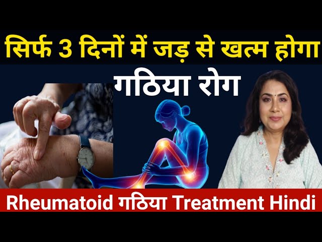 सन्निपातिक आर्थराइटिस एवं स्पॉन्डिलाइटिस